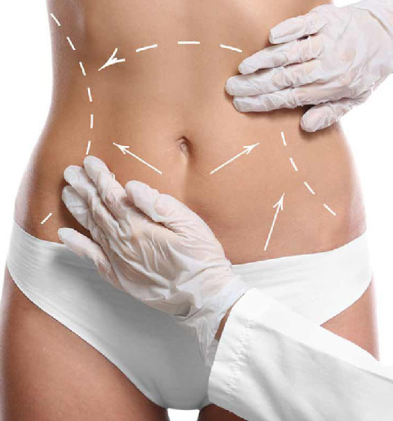Everything About Liposuction
